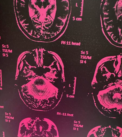 小鬼黑胶全新 感兴趣的话点“我想要”和我私...