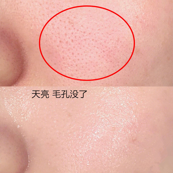 【小红书达人推荐】收缩毛孔精华液~ 全脸可...