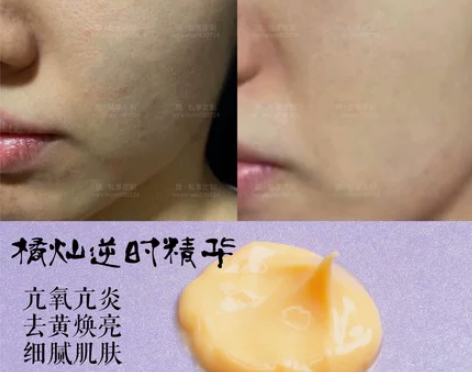 【素颜爱素颜】【橘灿逆时精华】亢氧焕亮 调...