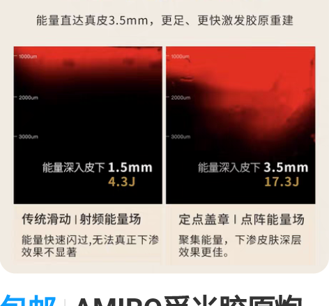 包邮初普TriPollar奇迹S美容仪St...