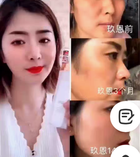 包邮一瓶喷雾,颠覆了全世界; 一瓶喷雾,还...