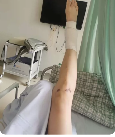 由于上周被汽车撞到腿，急需凑钱做手术 现在...